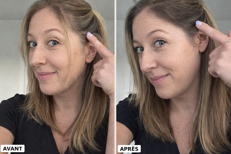 Avant après — Nadia, 43 ans