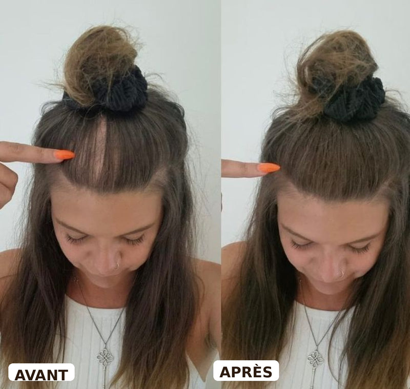 Avant après — Laura, 32 ans