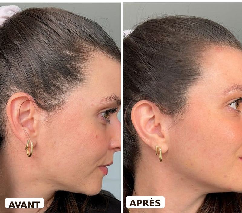 Avant après — Éléonore, 35 ans