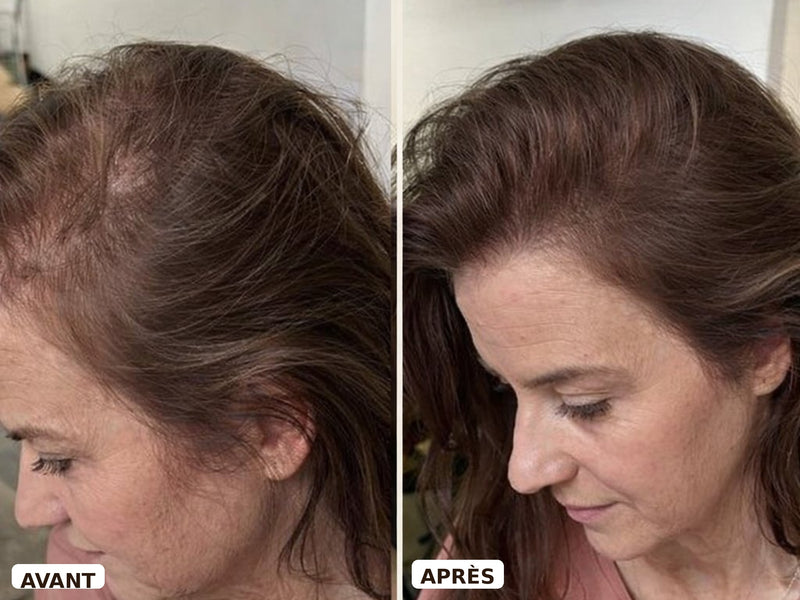 Avant après — Christine, 48 ans